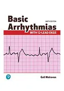 basis-arrhythmias