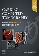 cardiac-computed-tomograph