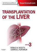 transplantation-of-the-liver