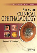 atlas-of-clinical-ophthalmology