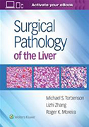 surgical-pathology-of-the-liver