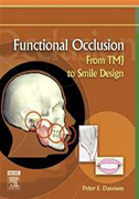 functional-occlusion