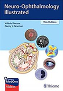 neuro-ophthalmology-illustrated