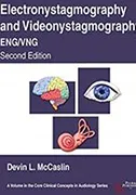 electronystamography-videonystagmography