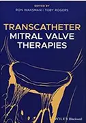transcatheter-mitral-valve-therapies