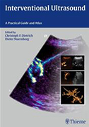 interventional-ultrasound