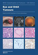 who-classification-of-tumours