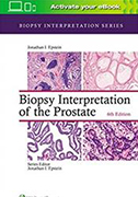 biopsy-interpretation