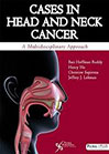 cases-in-head-and-neck-cancer