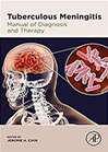 tuberculous-meningitis
