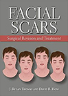 facial-scars