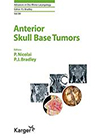 anterior-skull-base-tumors