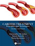 carotid-endarterectomy-books