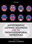 amyotrophic-lateral-sclerosis-books