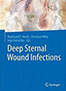 deep-sternal-wound-infections-books