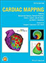 cardiac-mapping