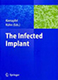 infected-implant-books