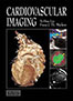 cardiovascular-imaging