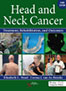 head-and-neck-cancer