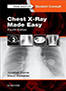 chest-x-ray-made-easy-books