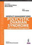 polycystic-ovarian-syndrome-books