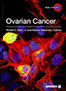 ovarian-cancer-books
