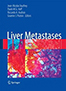 liver-metastases