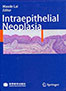 intraepithelial-neoplasia