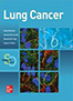 lung-cancer-standards-books