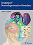 imaging-of-neurodegenerative