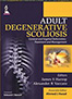 adult-degenerative-scoliosis-books