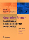 laparoscopic-sigmoidectomy