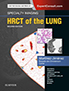 specialty-imaging-hrct-of-the-lung-books