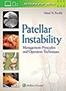 patellar-instability