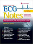 ecg-notes-interpretation-and-management-guide-books