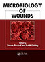 microbiology-of-wounds