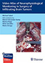 video-atlas-of-neurophysiologi-al-monitoring-books