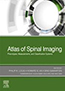 atlas-of-spinal-imaging