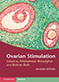 ovarian-stimulation