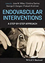 endovascular-interventions