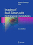 imaging-of-brain-tumors