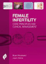 female-infertility