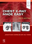 chest-x-ray-made-easy-books