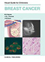 Fbreast-cancer-books