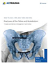 fractures-of-the-pelvis-books