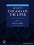 schiff's-diseases-of-the-liver-books